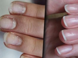 5 средств восстановить ногти после гель лака